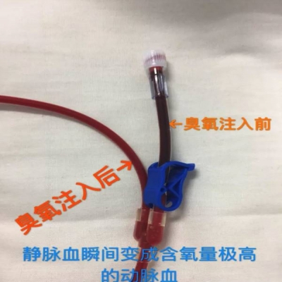 張家口市第六醫(yī)院 開展免疫三氧大自血療法